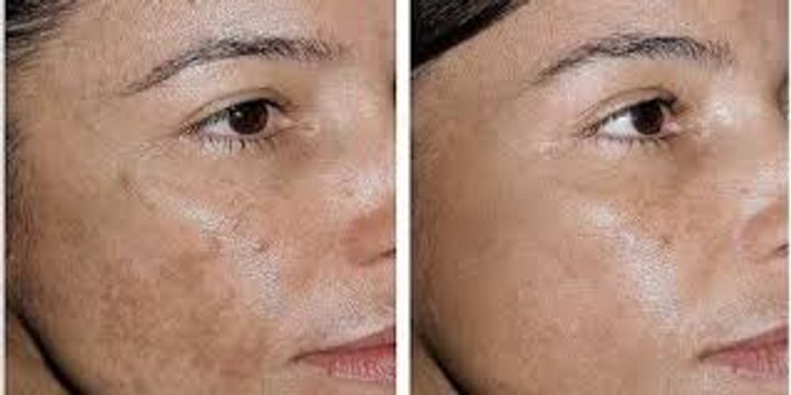 116. Two Ingredients say goodbye to wrinkles and sagging facial skin with this simple recipe. It's amazing.!