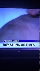 Grâce au mental de Vegeta de Dragon Ball Z, un jeune garçon survit à une attaque d'abeilles !