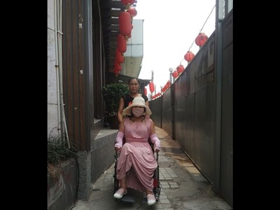 Hậu quả kinh hoàng của cô gái phẫu thuật thẩm mĩ 200 lần