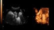 100% of the 3D & 4D scans at Fetal Studio