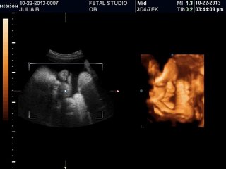 100% of the 3D & 4D scans at Fetal Studio