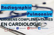 Examens Complémentaires - Radiographie Pulmonaire en Cardiologie