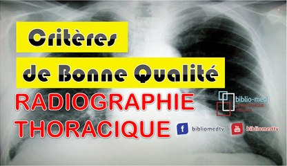 Radiographie du Thorax - Critères de Bonne Qualité d'une Radiographie Thoracique