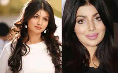 Ayesha Takia SHOCKING After Plastic Surgery Pictures