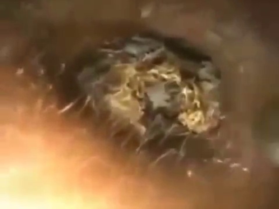 The Big Earwax Removal #15
