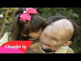 Chuyện lạ Việt Nam – Câu chuyện cảm động về người đàn ông không mặt