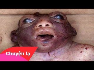 Chuyện lạ Việt Nam – Em bé nửa người nửa ếch