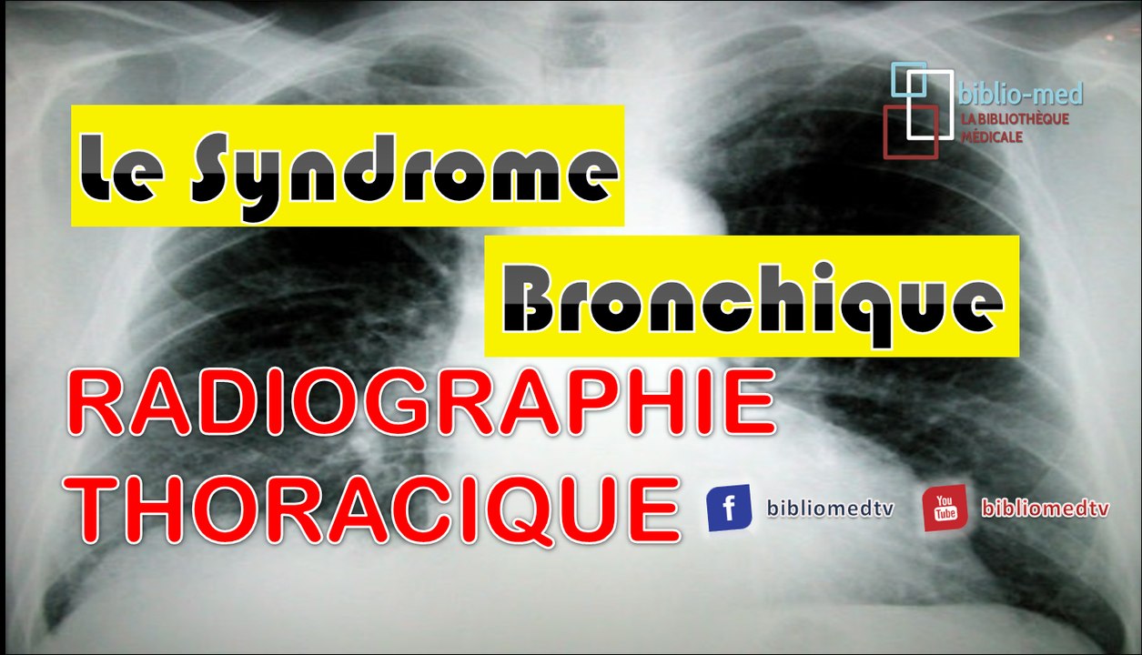Radiographie du Thorax - Syndrome Bronchique - Vidéo Dailymotion