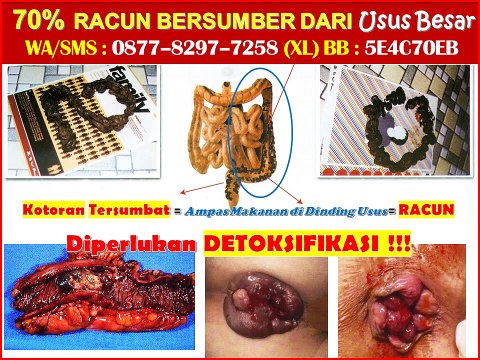 0877-8297-7258 (XL), Cara Jadi Agen Fiforlif