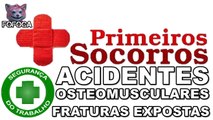 Técnico de Segurança do Trabalho - Primeiros Socorros - Acidentes Osteomusculares - Fraturas Expostas