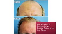 Best Hair Transplant in Miami - Revive Hair Restoration Miami FL