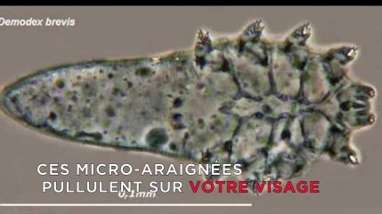 Ces micro-araignées pullulent sur votre visage