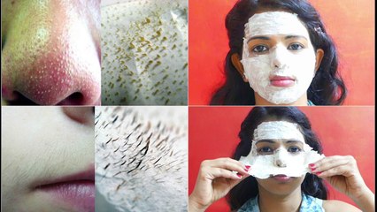 Voici comment supprimer les points noirs sur votre visage de façon naturelle