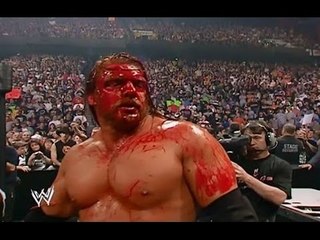 WWE Triple H vs Kevin Nash KILLING MATCH Triple H almost died