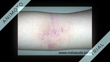 manchas vermelhas nas pernas o que pode ser