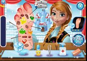 Disney Frozen Anna Game - Anna Foot Doctor - Games For Kids in HD new