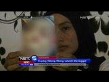 Hidung Pasien Hilang Setelah Dinyatakan Meninggal - NET5