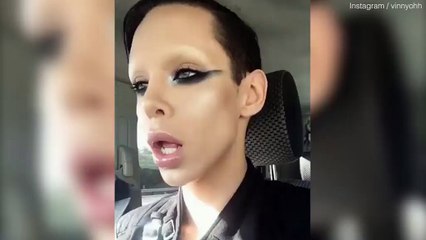 110 Chirurgies Et 50.000€ Pour Réaliser Son Rêve... Devenir Un Extra-Terrestre Sans S*xe!
