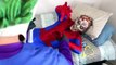 Superhero Monster Club Doctor Joker tries to fix Spiderman vs Zombie vs Venom vs Elsa