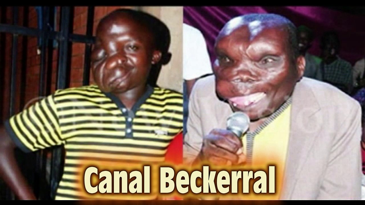 Homem mais feio de Uganda casou-se duas vezes e possui 8 filhos