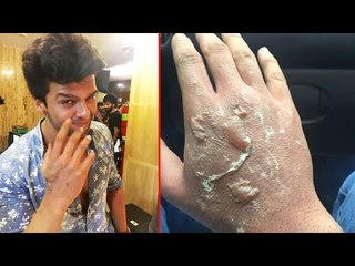 Kushal Tandon suffers burns while saving co-star on the sets of Beyhadh | Filmibeat