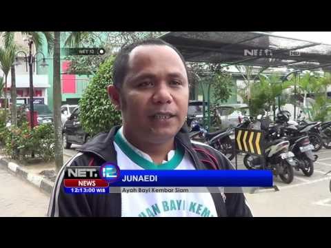 33 Dokter Tangani Bayi Kembar Siam - NET12