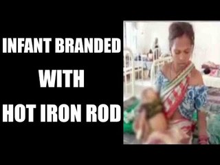 Odisha infant branded with hot iron rod : Watch video | Oneindia News