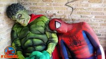 Doctor Spiderman in Real Life Spiderman Doctor with Minions Hulk Joker Amazing Superheroes