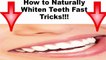 How to Naturally Whiten Teeth Fast- Teeth Whitening at Home Remedies