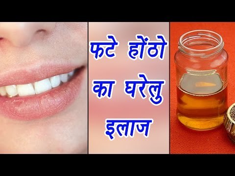 Home remedies for (फटे होंठ) cracked lips | Boldsky