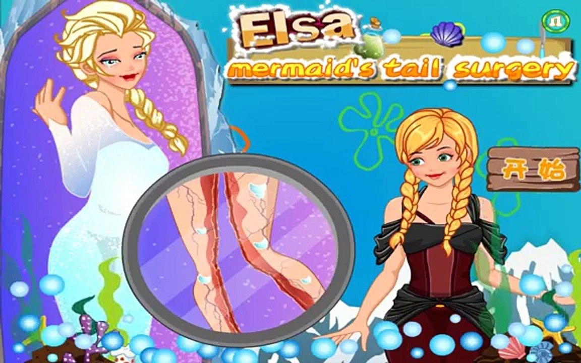 Elsa Mermaids Tail Surgery - Disney Princess Game For Kids