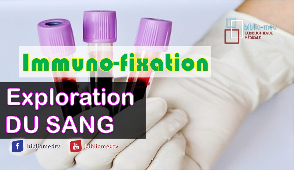 Exploration du Sang - Immunofixation