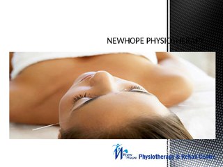 Acupuncture Treatment in Brampton