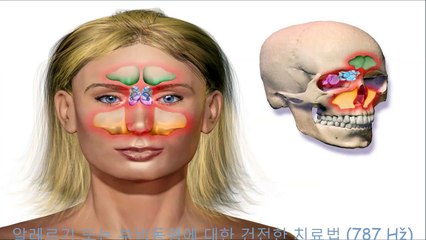 알레르기 또는 부비동염에 대한 건전한 치료법 (787 Hž)