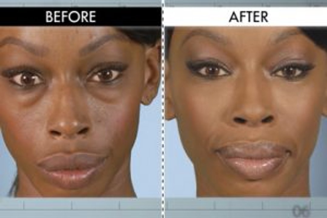 10 traitement naturel pour se debarasser de cernes !