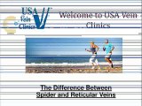 Spider Vein & Reticular Vein Treatment - USA Vein Clinics