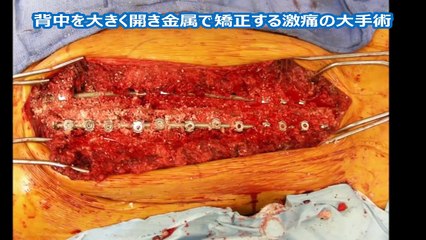 |新しい| 面白い | 【閲覧注意】グロ注意！美女のアソコがヤバイ！世界が震えた！ 時計 HD