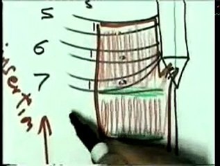 04 Antreo Lateral Abdominal Wall