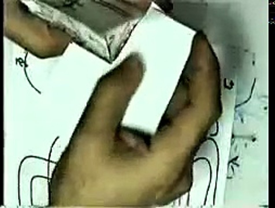 10 Peritoneum 2