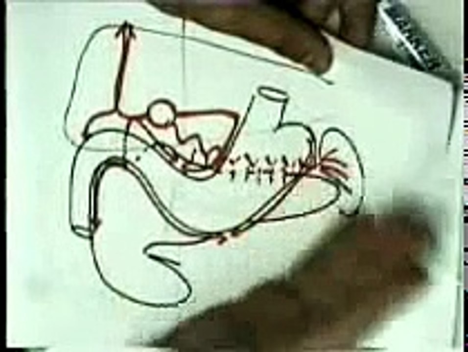 11- 20 Blood Supply 3