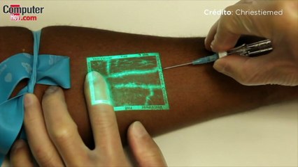 Estudiantes de enfermería: VeinViewer viene a facilitaros la vida