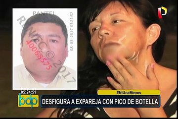 Mujer denuncia que expareja la desfiguró con pico de botella