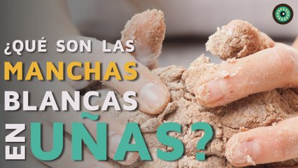 ¿Qué son las manchas blancas en las uñas?