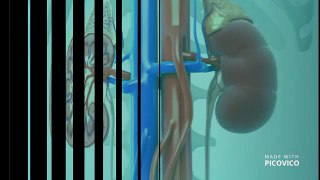 Kidney Treatment In India