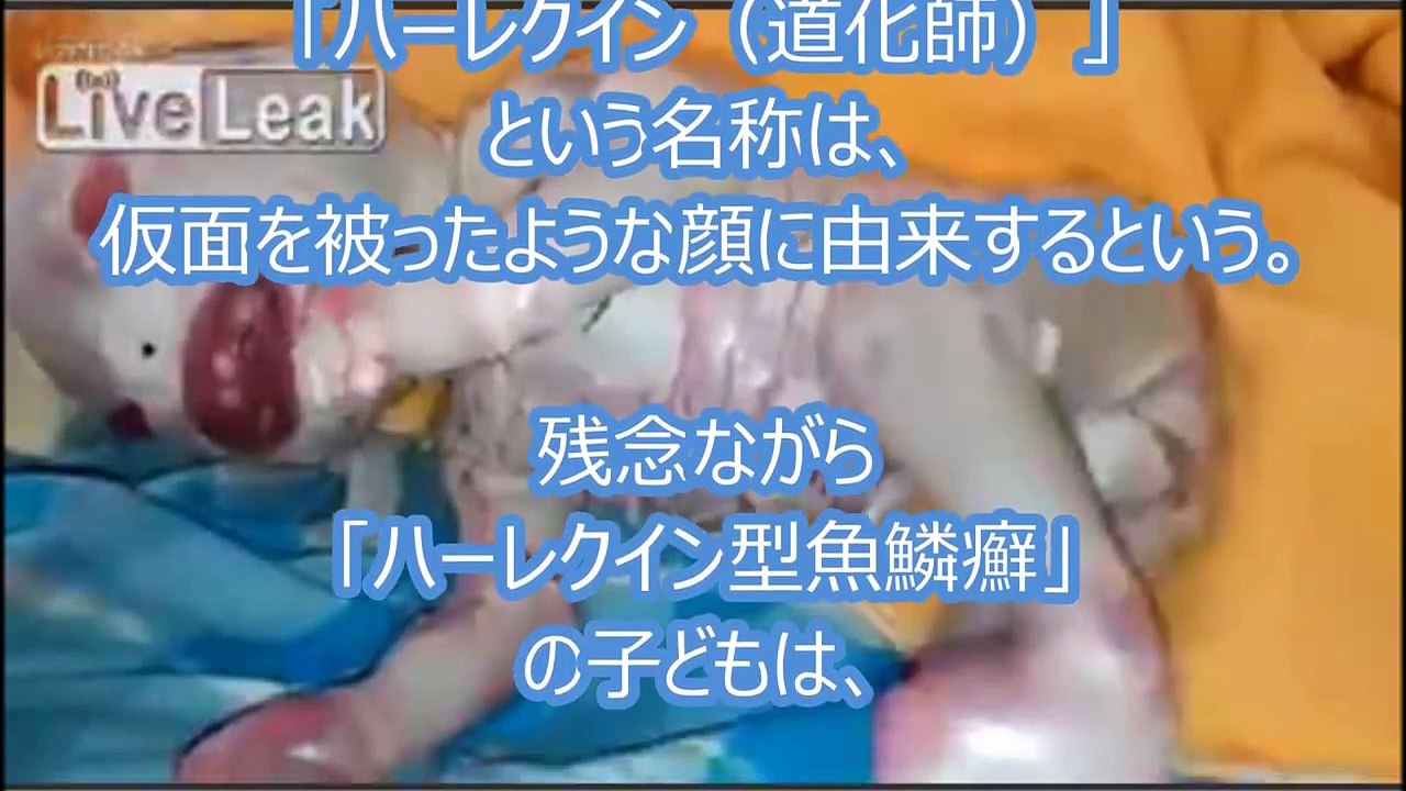 魚鱗 ハーレクイン 型