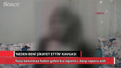 Kız öğrencilerin kavgası karakolda bitti