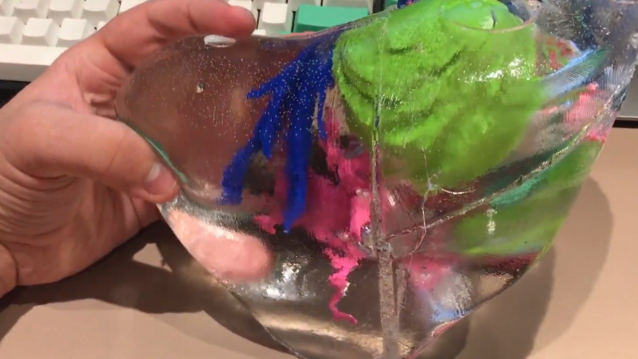 3D-Printed Livers Help Doctors Prepare For Surgery