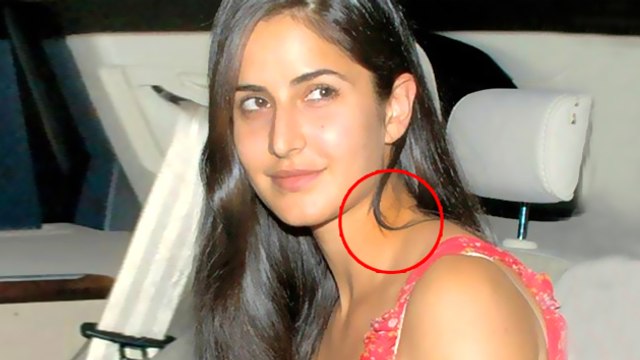 Katrina Kaif Severely Injured On the Sets Of Jagga Jasoos | Bollywood Buzz