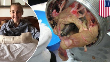 Virginia chef loses hand to meat grinder