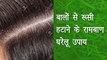 बालों से रूसी हटाने के रामबाण घरेलू उपाय I आयुर्वेद इंडिया I Ayurveda India